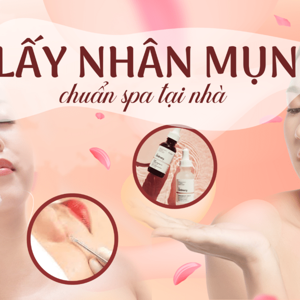 7 bước lấy nhân mụn chuẩn spa tại nhà 