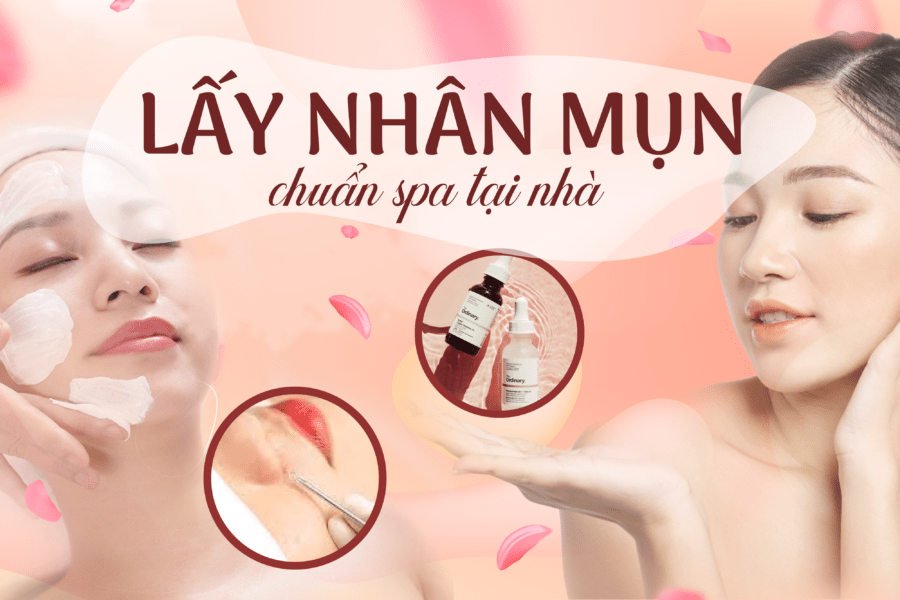 7 bước lấy nhân mụn chuẩn spa tại nhà 