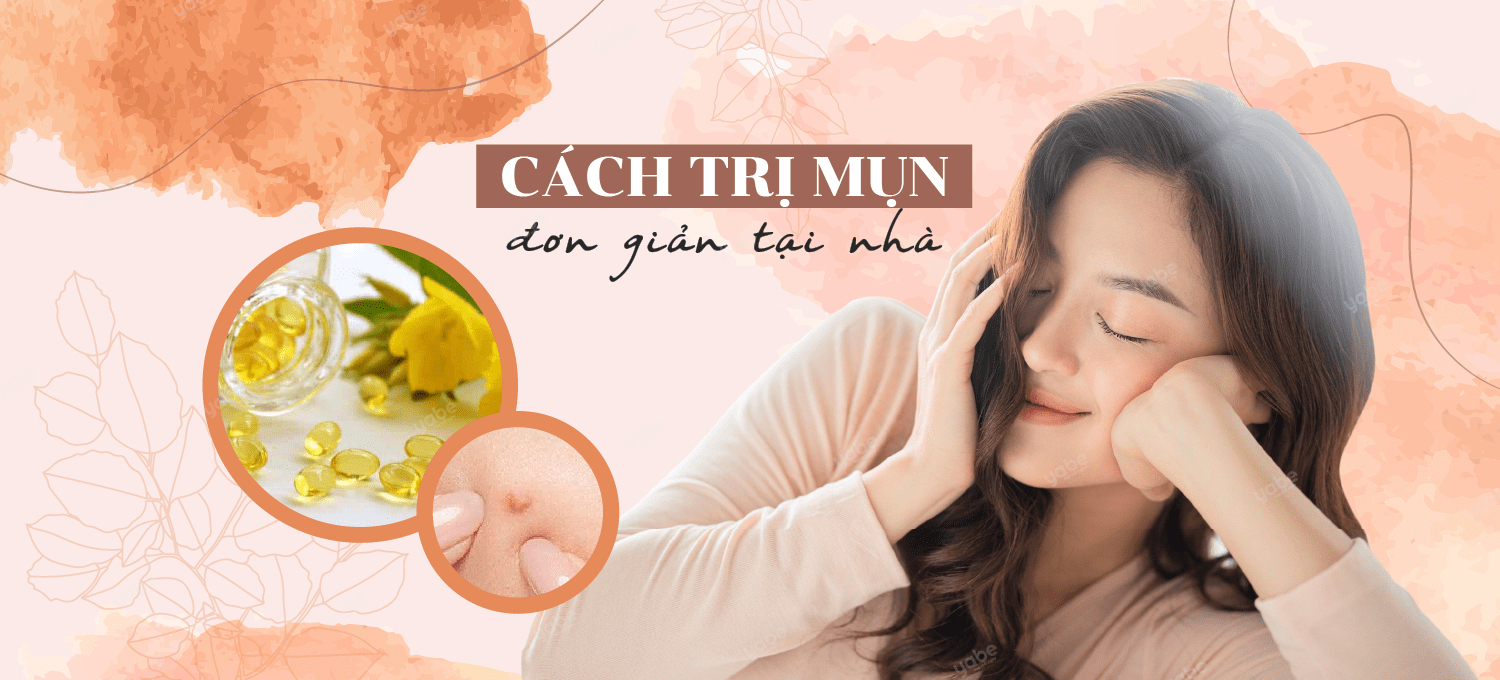 cách giảm mụn đơn giản tại nhà