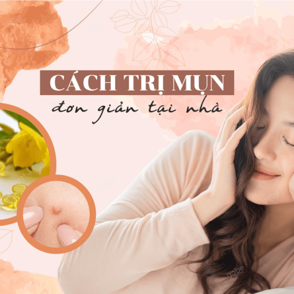 cách giảm mụn đơn giản tại nhà