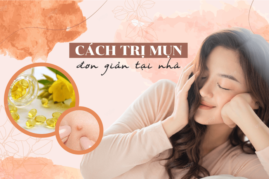 cách giảm mụn đơn giản tại nhà