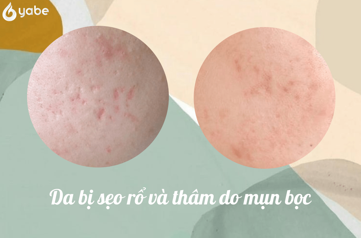 Sản phẩm tẩy tế bào chết