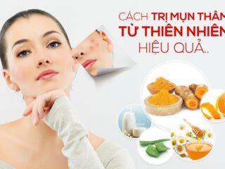 Trị thâm mụn