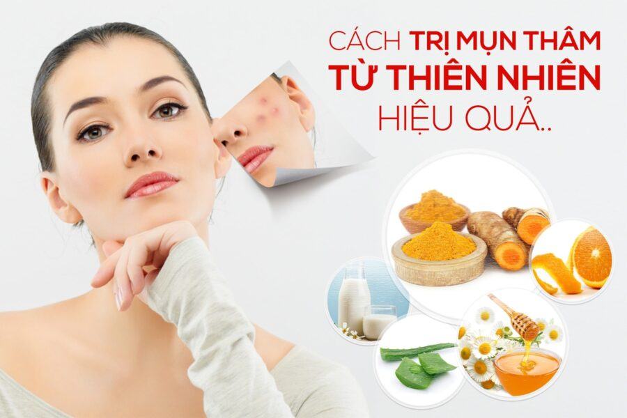 Trị thâm mụn