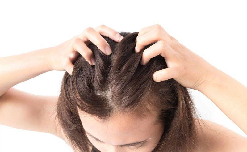 5 tips chăm sóc tóc tẩy dành cho người đam mê làm mới tóc 50 Tổn thương da đầu gây khó chịu do tẩy tóc