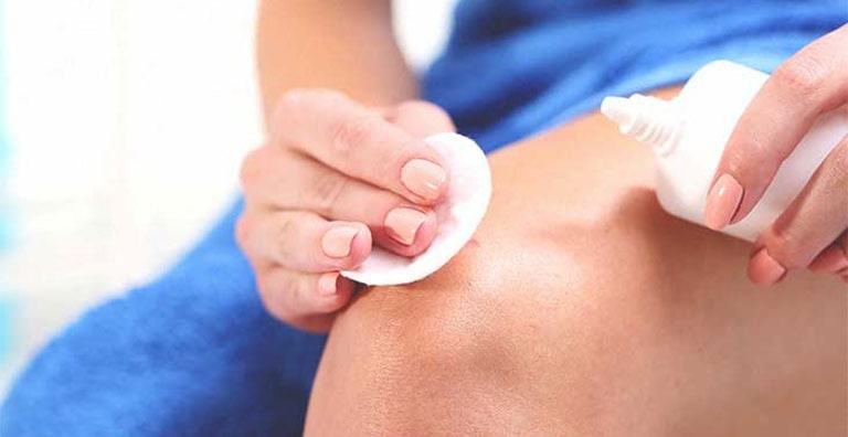 4 cách giảm sưng mụn cấp tốc hiệu quả