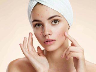 kem dưỡng ẩm cho da dầu mụn